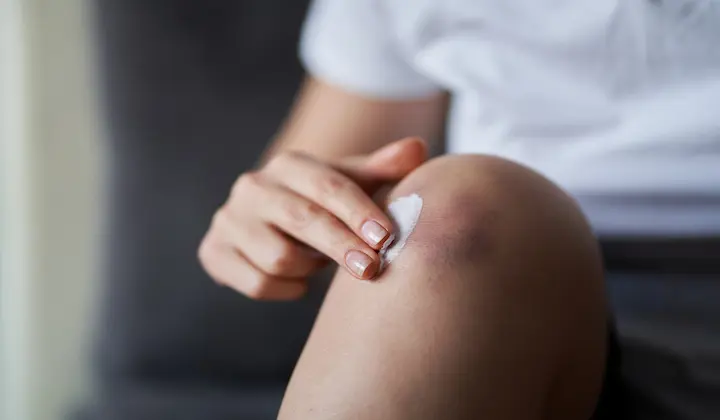 Apply ice, wrap with a bandage, elevate, use aloe vera for faster bruise healing. 